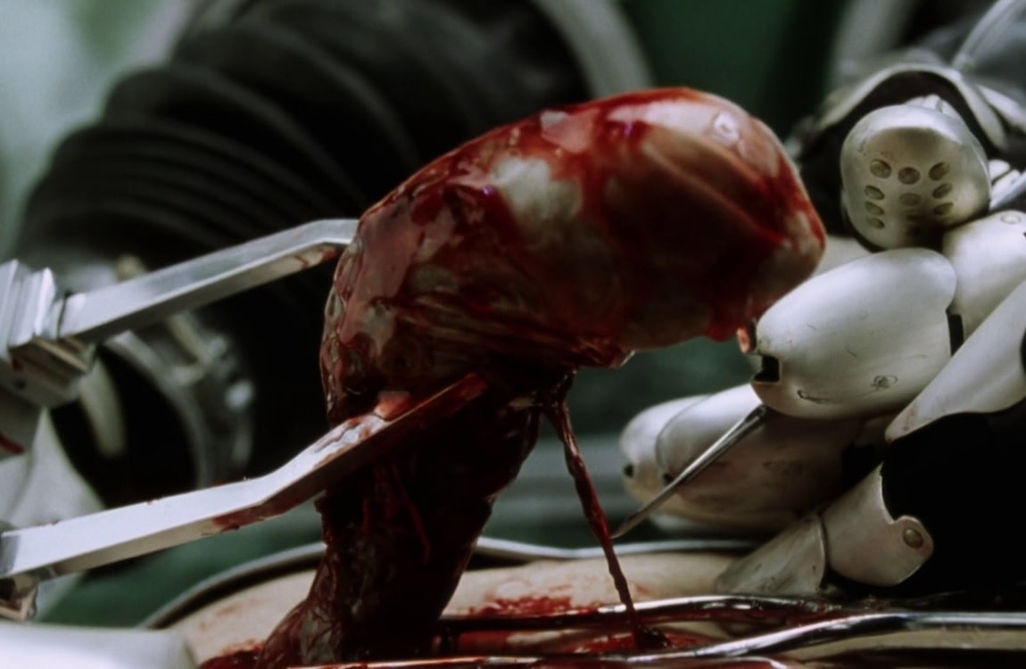 The chestburster removal from Ripley 8 in Alien: Resurrection
