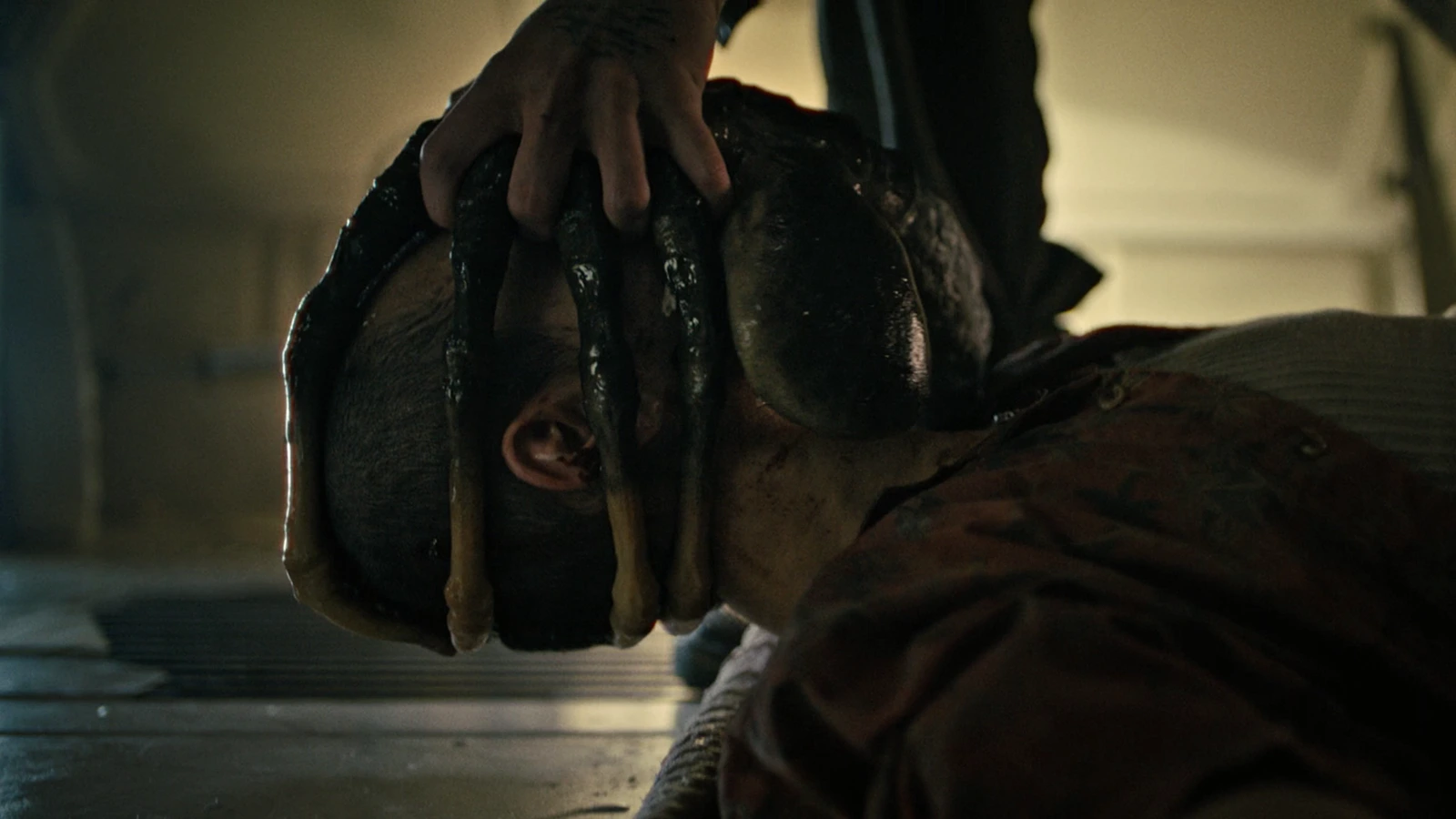 Navarro's Facehugger being pulled off in Alien: Romulus