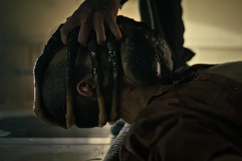 Navarro's Facehugger being pulled off in Alien: Romulus