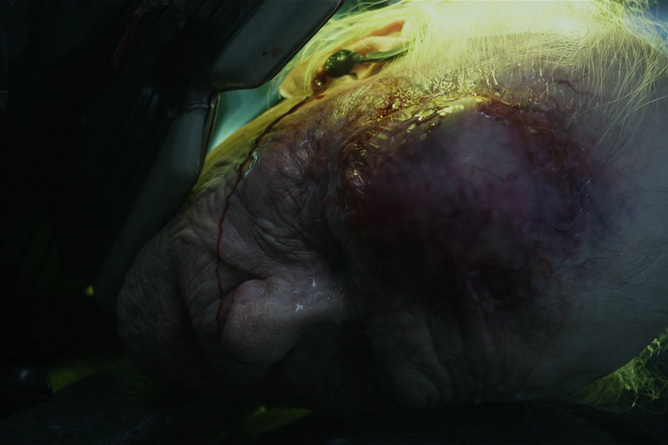 Peter Weyland's torn scalp after the Engineer struck him down on LV-223